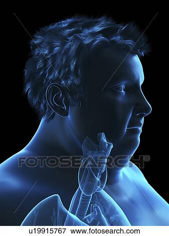 Stock Photo - Illustration of an obese man's throat anatomy. Fotosearch