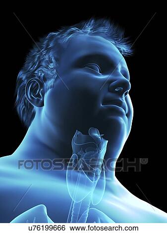 Stock Photograph - Illustration of an obese man's throat anatomy. Fotosearch