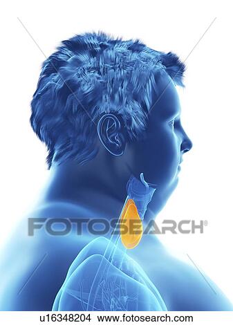 Picture - Illustration of an obese man's thyroid gland. Fotosearch