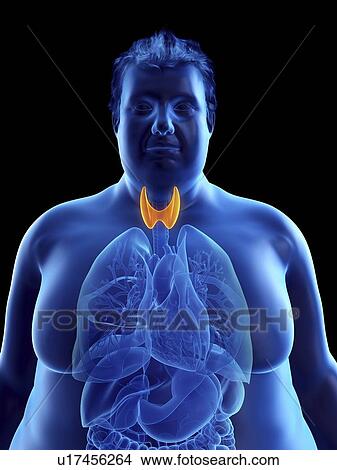 Picture - Illustration of an obese man's thyroid gland. Fotosearch