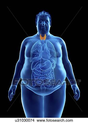Picture - Illustration of an obese man's thyroid gland. Fotosearch
