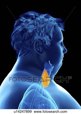 Stock Photo - Illustration of an obese man's thyroid gland. Fotosearch