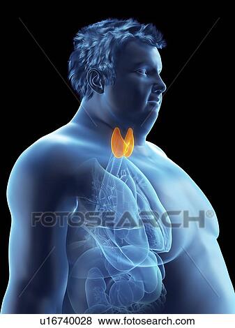 Stock Photo - Illustration of an obese man's thyroid gland. Fotosearch