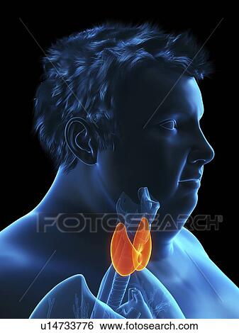 Stock Photograph - Illustration of an obese man's thyroid gland. Fotosearch