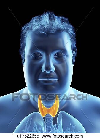 Illustration of an obese man's thyroid gland View Large Photo Image Stock Photography - Illustration of an obese man's thyroid gland. Fotosearch