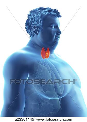 Stock Photography - Illustration of an obese man's thyroid gland. Fotosearch