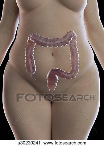 Illustration of an obese woman's colon View Large Photo Image Stock Image - Illustration of an obese woman's colon. Fotosearch