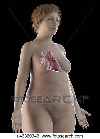 Stock Image - Illustration of an obese woman's heart. Fotosearch