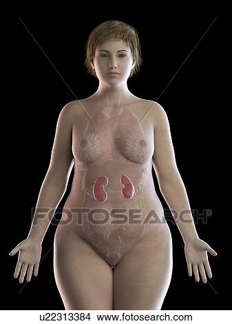 Picture - Illustration of an obese woman's kidneys. Fotosearch
