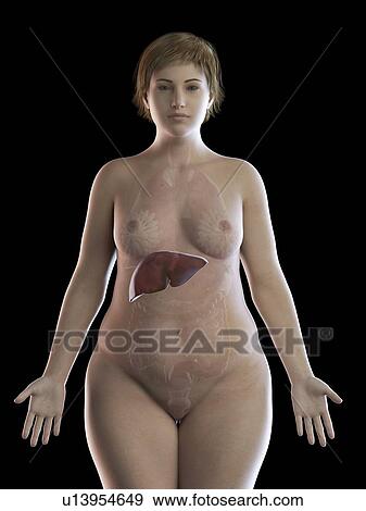 Stock Photo - Illustration of an obese woman's liver. Fotosearch