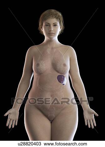 Stock Image - Illustration of an obese woman's spleen. Fotosearch