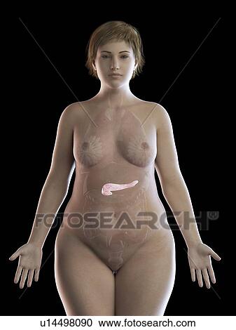 Illustration of an obese woman's pancreas View Large Photo Image Stock Image - Illustration of an obese woman's pancreas. Fotosearch