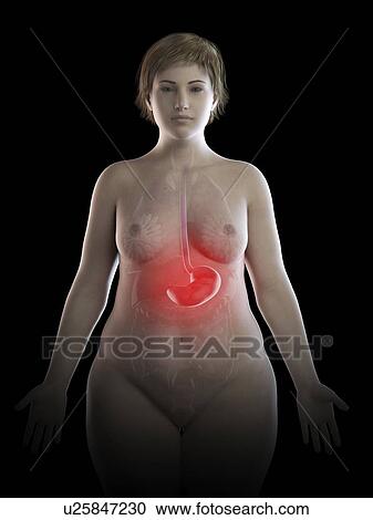 Stock Image - Illustration of an obese woman's painful stomach. Fotosearch