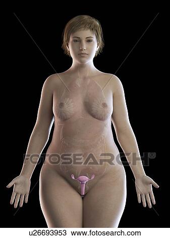 Stock Image - Illustration of an obese woman's uterus. Fotosearch