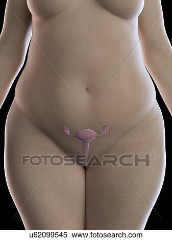 Stock Photography - Illustration of an obese woman's uterus. Fotosearch