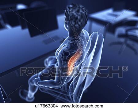 Illustration of an office worker with a painful back View Large Photo Image Picture - Illustration of an office worker with a painful back. Fotosearch