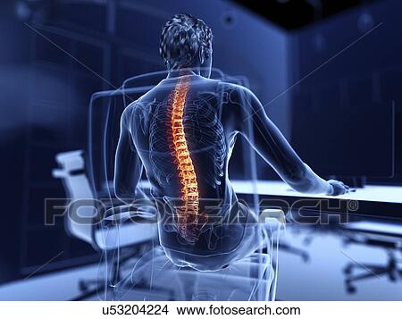 Picture - Illustration of an office worker with a painful back. Fotosearch