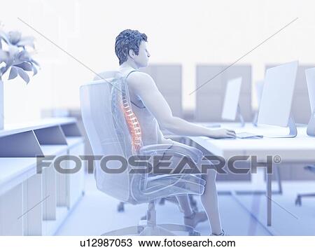 Stock Image - Illustration of an office worker with a painful back. Fotosearch