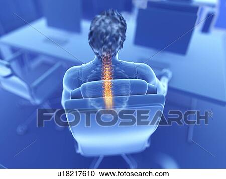 Illustration of an office worker with a painful back View Large Photo Image Stock Image - Illustration of an office worker with a painful back. Fotosearch