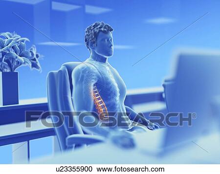 Illustration of an office worker with a painful back View Large Photo Image Stock Image - Illustration of an office worker with a painful back. Fotosearch