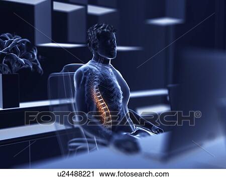 Stock Image - Illustration of an office worker with a painful back. Fotosearch