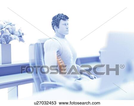 Stock Image - Illustration of an office worker with a painful back. Fotosearch