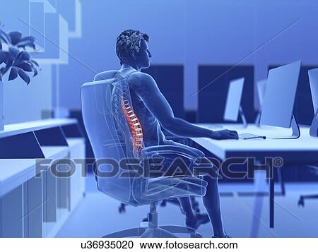 Stock Image - Illustration of an office worker with a painful back. Fotosearch
