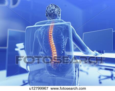 Illustration of an office worker with a painful back View Large Photo Image Stock Photo - Illustration of an office worker with a painful back. Fotosearch