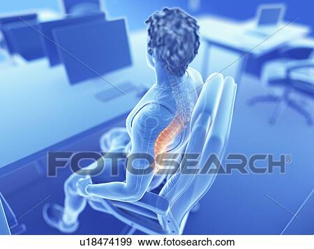 Illustration of an office worker with a painful back View Large Photo Image Stock Photo - Illustration of an office worker with a painful back. Fotosearch