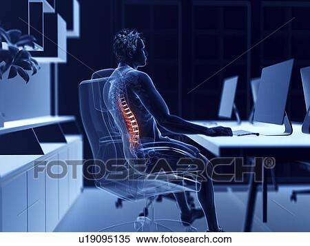 Stock Photography - Illustration of an office worker with a painful back. Fotosearch