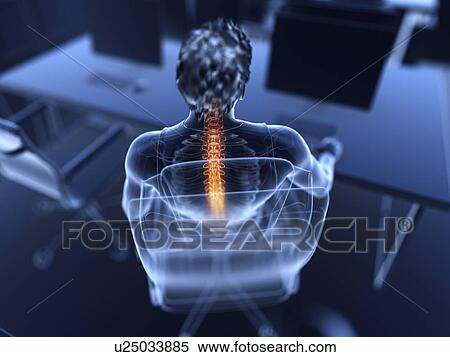 Stock Photography - Illustration of an office worker with a painful back. Fotosearch