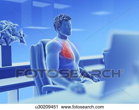 Stock Image - Illustration of an office worker's vascular system. Fotosearch