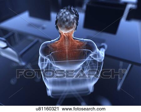 Stock Image - Illustration of an office worker's painful muscles. Fotosearch