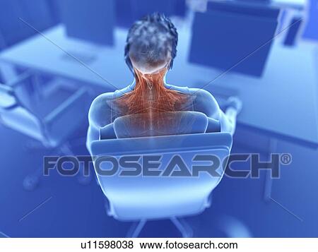 Illustration of an office worker's painful muscles View Large Photo Image Stock Photo - Illustration of an office worker's painful muscles. Fotosearch