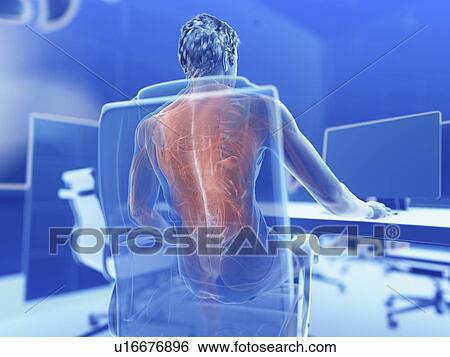 Stock Photograph - Illustration of an office worker's painful muscles. Fotosearch
