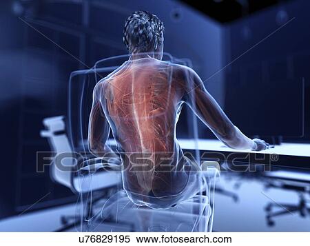 Stock Photography - Illustration of an office worker's painful muscles. Fotosearch