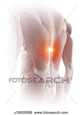 Illustration of back muscle pain View Large Photo Image Stock Photograph - Illustration of back muscle pain. Fotosearch