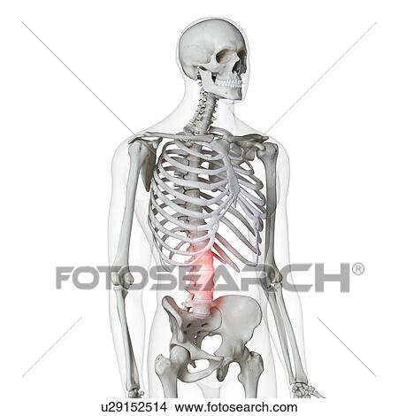 Picture - Illustration of pain in the lower spine. Fotosearch