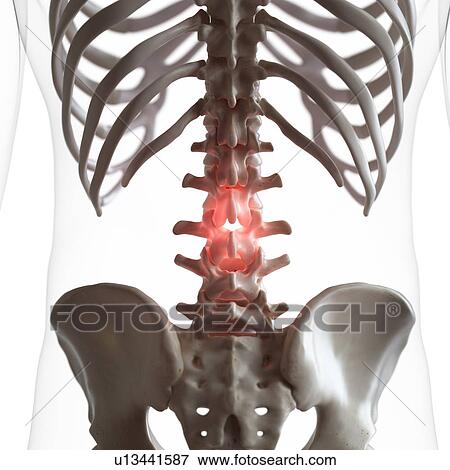 Illustration of pain in the lower spine View Large Photo Image Stock Photo - Illustration of pain in the lower spine. Fotosearch