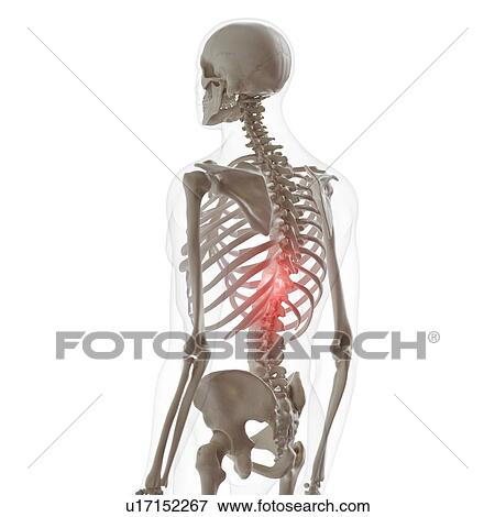 Stock Photo - Illustration of pain in the lower spine. Fotosearch