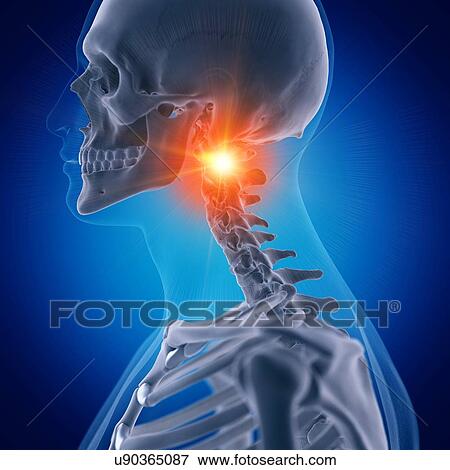 Stock Photo - Illustration of painful atlas bone. Fotosearch