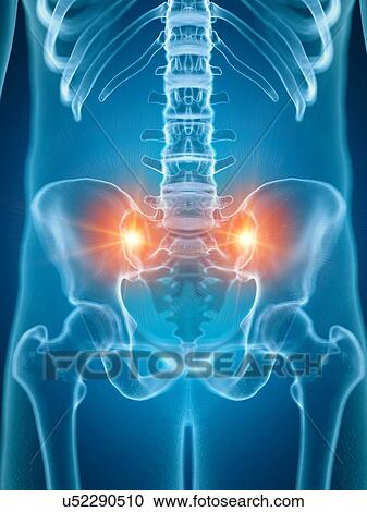 Stock Image - Illustration of painful sacrum joints. Fotosearch