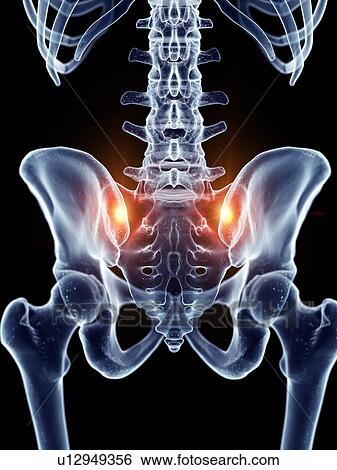 Stock Photograph - Illustration of painful sacrum joints. Fotosearch
