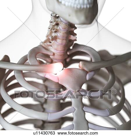 Illustration of painful sternoclavicular joint View Large Photo Image Stock Image - Illustration of painful sternoclavicular joint. Fotosearch