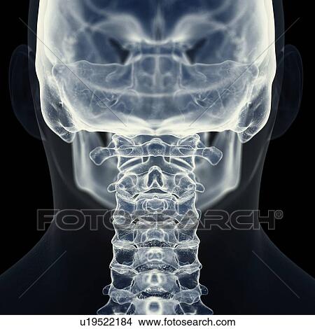 Picture - Illustration of the cervical spine. Fotosearch