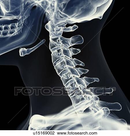 Illustration of the cervical spine View Large Photo Image Stock Image - Illustration of the cervical spine. Fotosearch