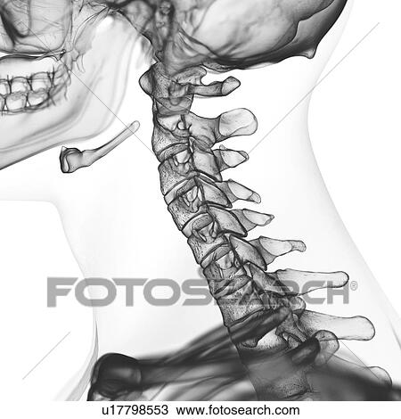 Stock Image - Illustration of the cervical spine. Fotosearch
