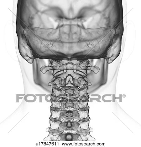 Stock Image - Illustration of the cervical spine. Fotosearch