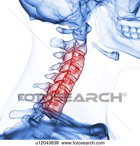 Illustration of the cervical spine View Large Photo Image Stock Photo - Illustration of the cervical spine. Fotosearch