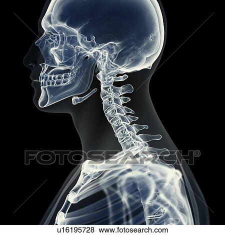 Illustration of the cervical spine View Large Photo Image Stock Photo - Illustration of the cervical spine. Fotosearch